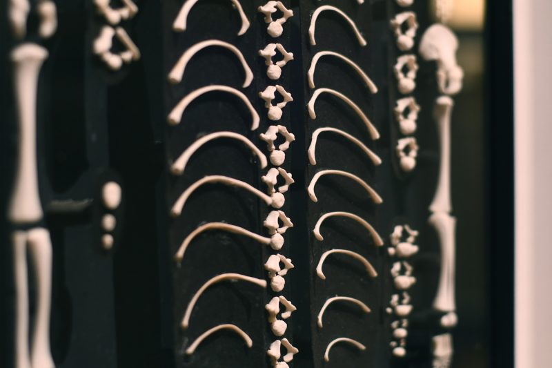 musée d’Anatomie de Strasbourg